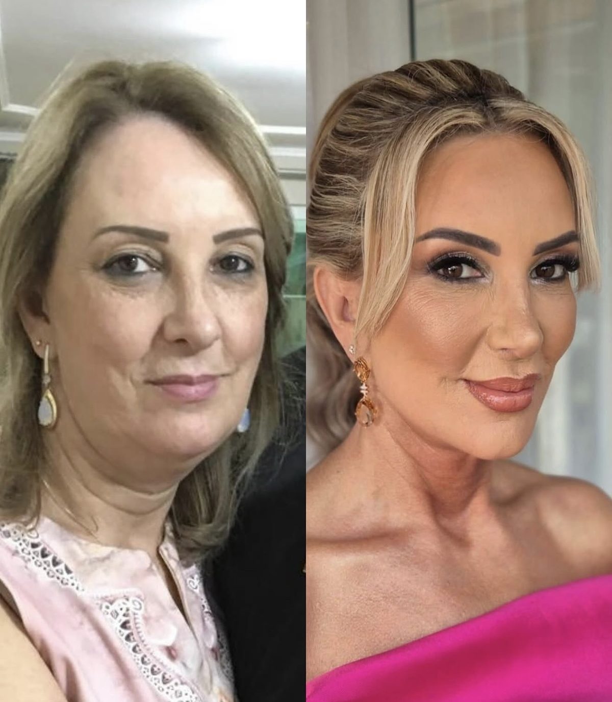 Antes e depois de uma paciente